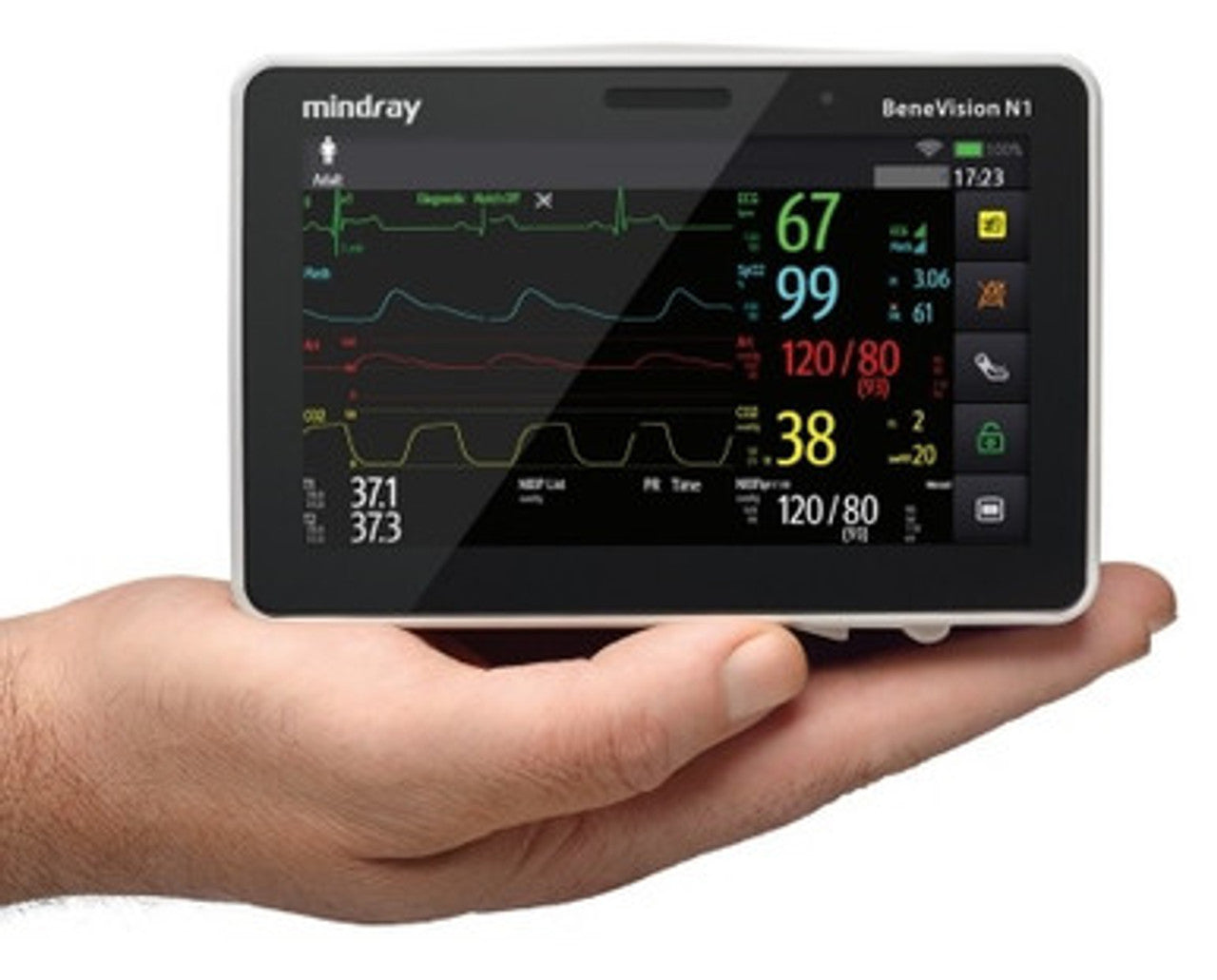 N1 Monitor with Masimo SET SpO2, Arrhythmia analysis, integrated CO2, 3/5/6-lead ECG, NIBP, two invasives, dual temperature, respiration, integrated battery, 2.4/5GHz wireless enabled (6660E-PA00019) (Continental US Only) (DROP SHIP ONLY) (Pricing Subject to Change without Notice)