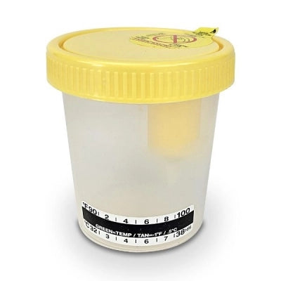 TransferTop Urine Collection Container with Integrated Transfer Device, 4 oz (120mL), Graduated to 100mL, Affixed Temperature Strip, Sterile, Bulk, 300/cs
