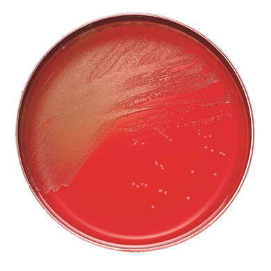 BBL Columbia CNA Agar Plate, with 5% Sheep Blood, 100/pk (Short-Dated; Temp Sensitive; Non-Returnable) (Continental US Only) (Drop Ship Requires Pre-Approval)