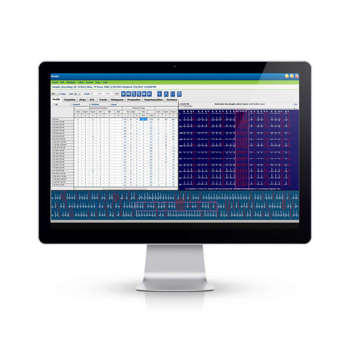 Hscribe Holter Analysis System, Version 6, with Adult & Pediatric Arrhythmia Analysis, DICOM (DROP SHIP ONLY) (US Only)