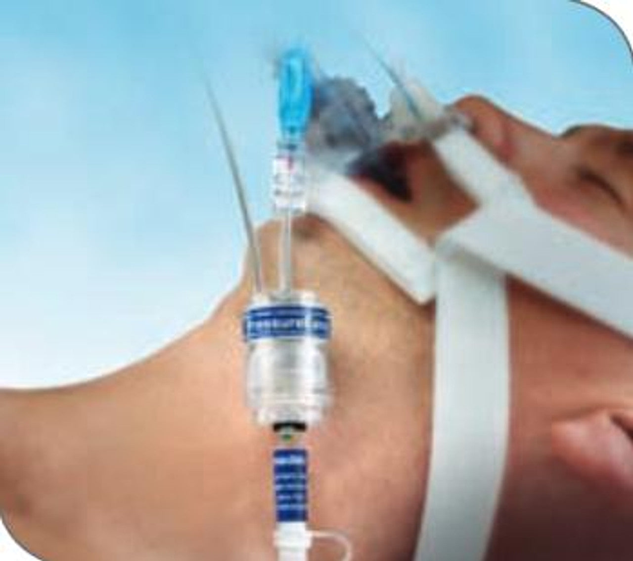 Endotracheal Tube Holder, Adult, 4.5 mm - 6.5 mm, Non-Sterile, 30/bx (US Only)