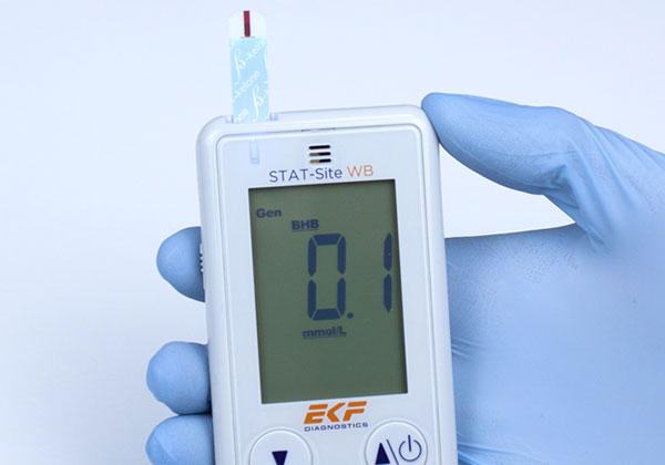 Stat-Site WB Blood Glucose Strips, for STAT-Site WM Dual Analyte Measurement System, 50strips/btl, 1btl/bx (US Only)