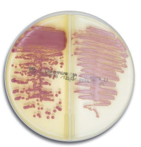 BBL CHROMagar MRSA/SA Medium Bi-Plate, 100/pk (DROP SHIP ONLY) (Temp Sensitive; Non-Returnable) (Continental US Only)