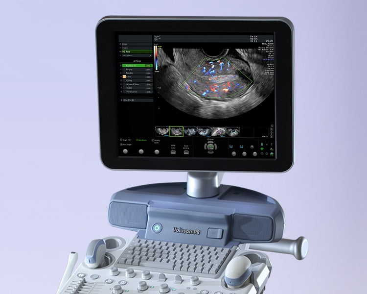 Voluson P8 2D BT22 (DROP SHIP ONLY) (Continental US Only) (Not Available to Vet or Government Markets) (Pricing Listed is an Estimate and may Change without Prior Notification; Please Contact your GE Sales Rep for an Accurate Price Quote)