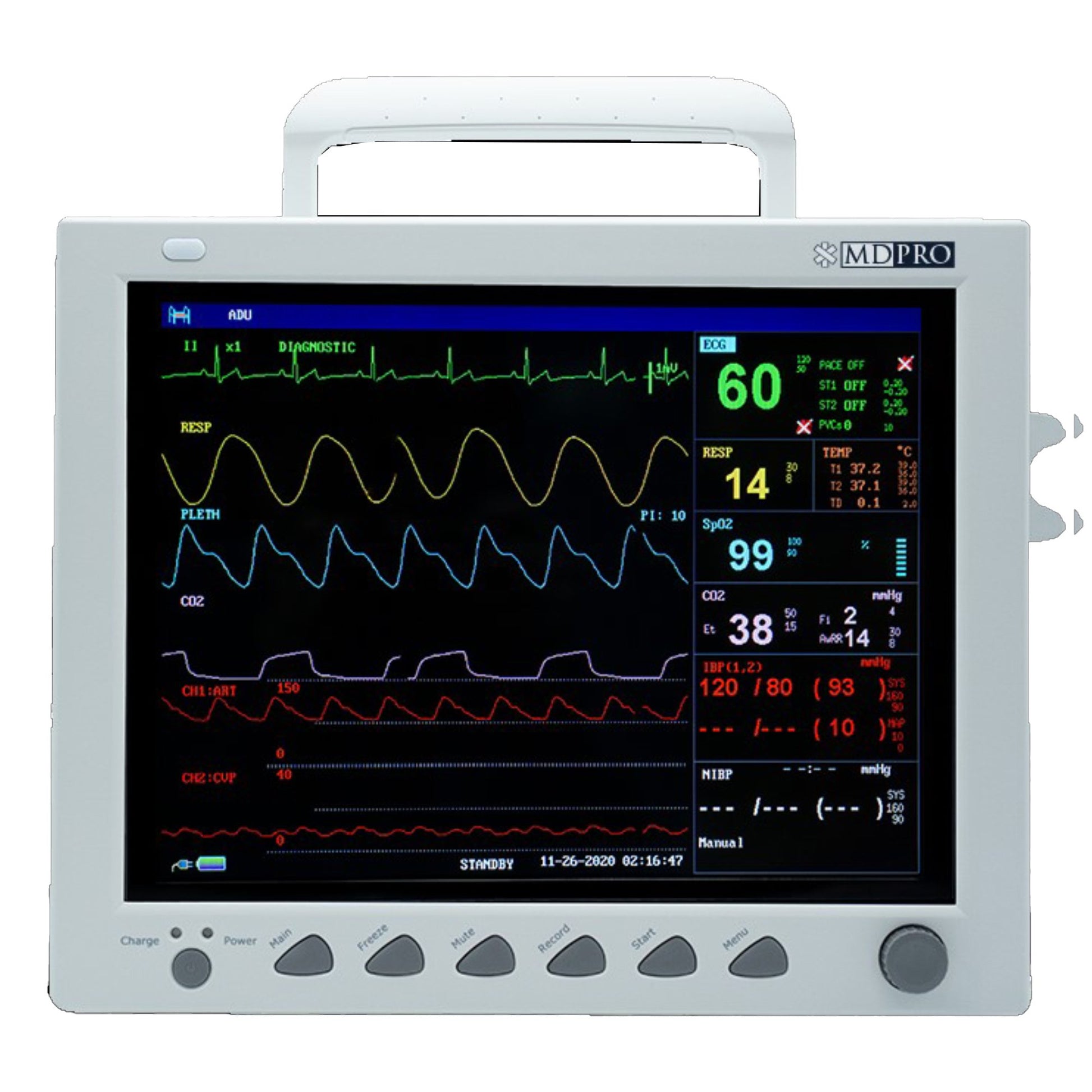 iM60 Patient monitor with 10'' touch screen and WiFi. 3/5-lead ECG, RESP, NIBP, 2-TEMP, PR, HR, EDAN SpO2 and internal OEM Edan Sidestream G2 CO2 module. Printer installed (DROP SHIP ONLY)