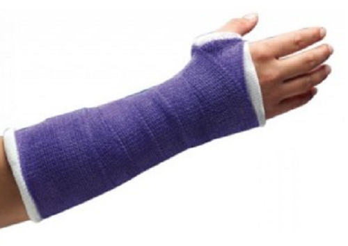 Delta-Cast Conformable Casting Tape, Polyester, 2" x 4 yd, Purple, 10/bx (Continental US Only)