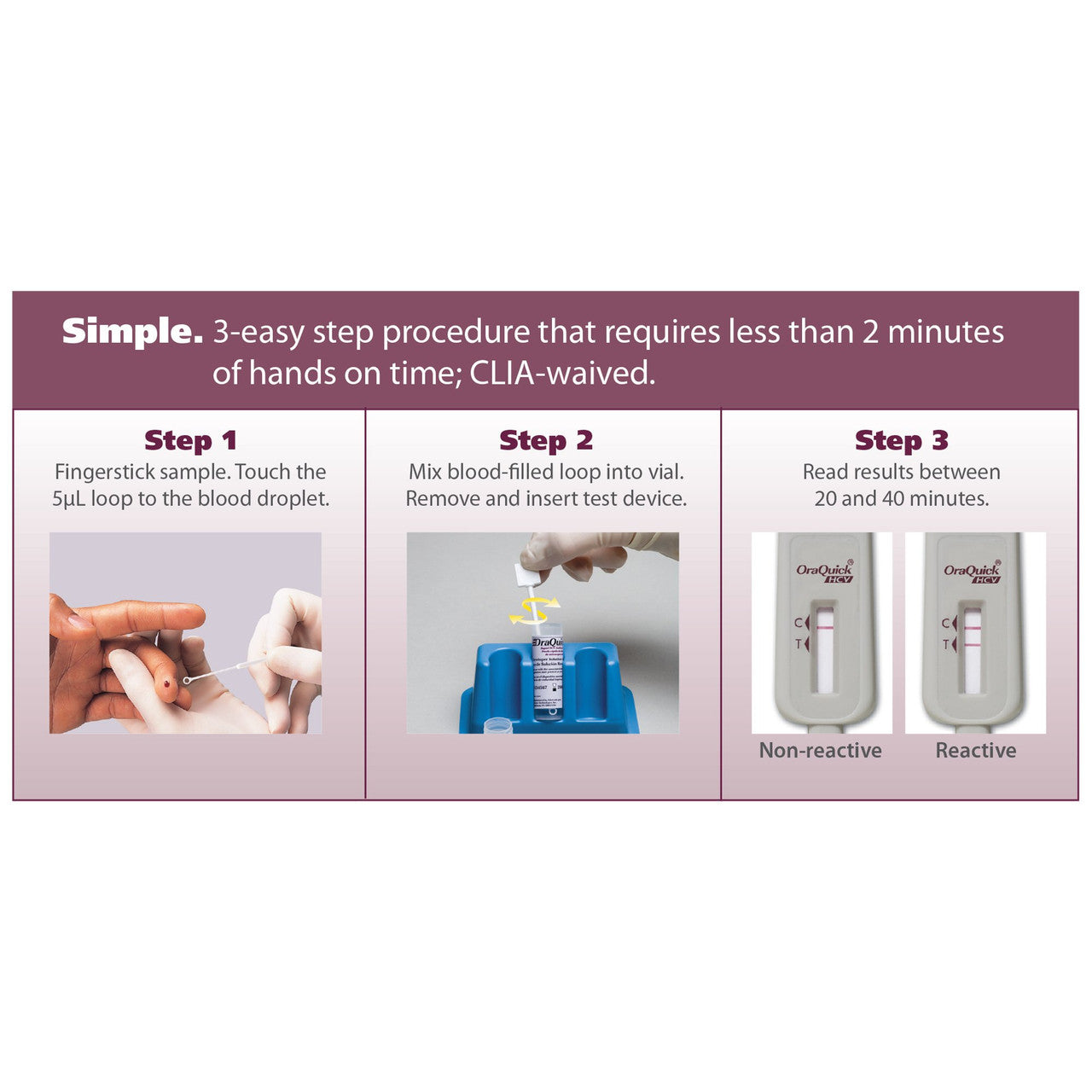 OraQuick HCV Rapid Test Kit, 20 minute Results, 25 Test Count Packaging Includes: (25) Divided Pouches Each Containing a Test Device, Absorbent Packet, Developer Solution Vial (each contains 0.75mL of a Buffered Saline Solution w/ an Antimicrobial Agent), (5) Reusable Test Stands, (25), Specimen Collection Loops, Package Inserted (120 kt/plt) (US Only)