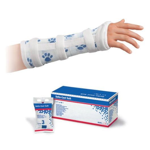 Delta-Cast II Cast Tape, Soft Paw Print, 2" x 4yd, 10 rl/cs (Continental US Only)