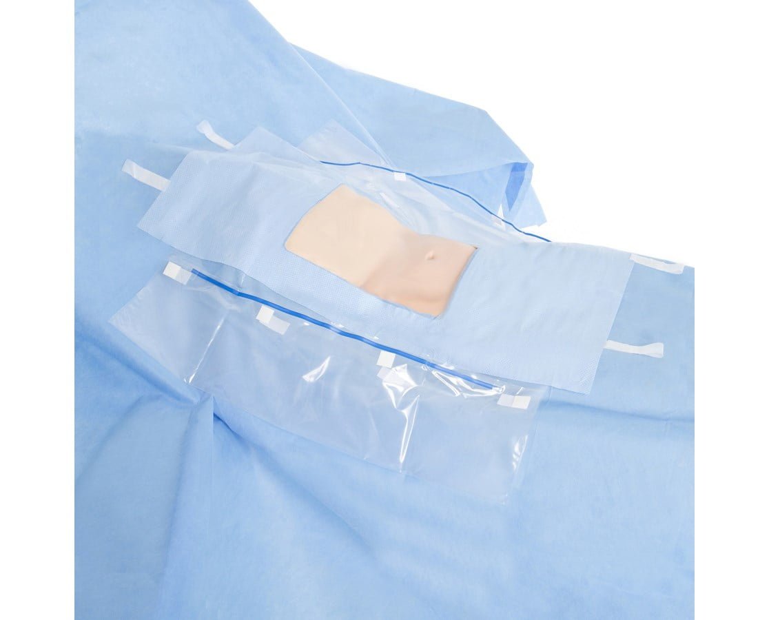Laparoscopic/ Cholecystectomy Drape, 102" x 72" x 120", Sterile, 10/cs (US Only)