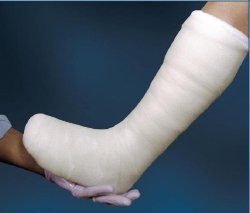 Cutimed Off-Loader, Plaster & Synthetic Combination Kit, Includes:  (1) Cutimed Cavity, (4) 2 x 2" Cotton Gauze, (2) 4" Ortho-Flex Elstaic Palster Rolls, (3) 4" Extra Fast Gypsona S Rolls, (1) 3" Delta-Lite Conformable Roll, (2) 4" Delta-Lite Conformable Rolls, (1) 3" Delta Terry-Net Stockinette, (2) 4" Specialist100 Cotton Cast Padding Rolls, (1) Delta Terry-Net Adhesive Felt & (1) Open Cell Foam, 1/kt (Continental US Only)