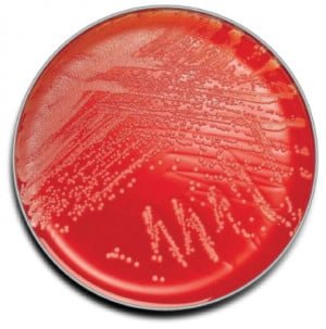 Plated Media, Prepared, Standard Methods Agar, Mono-Plate Format, 20/pk (Must be Refrigerated; Non-Returnable) (Continental US Only)  (Drop Ship Requires Pre-Approval)
