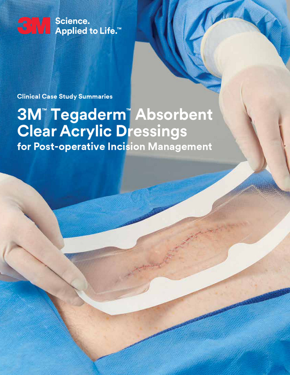 Dressing, Large Rectangle, Pad Size 1.75" x 8.", Overall Size 3.5" x 10", 30/pk, 4 pk/cs (Continental US+HI Only)