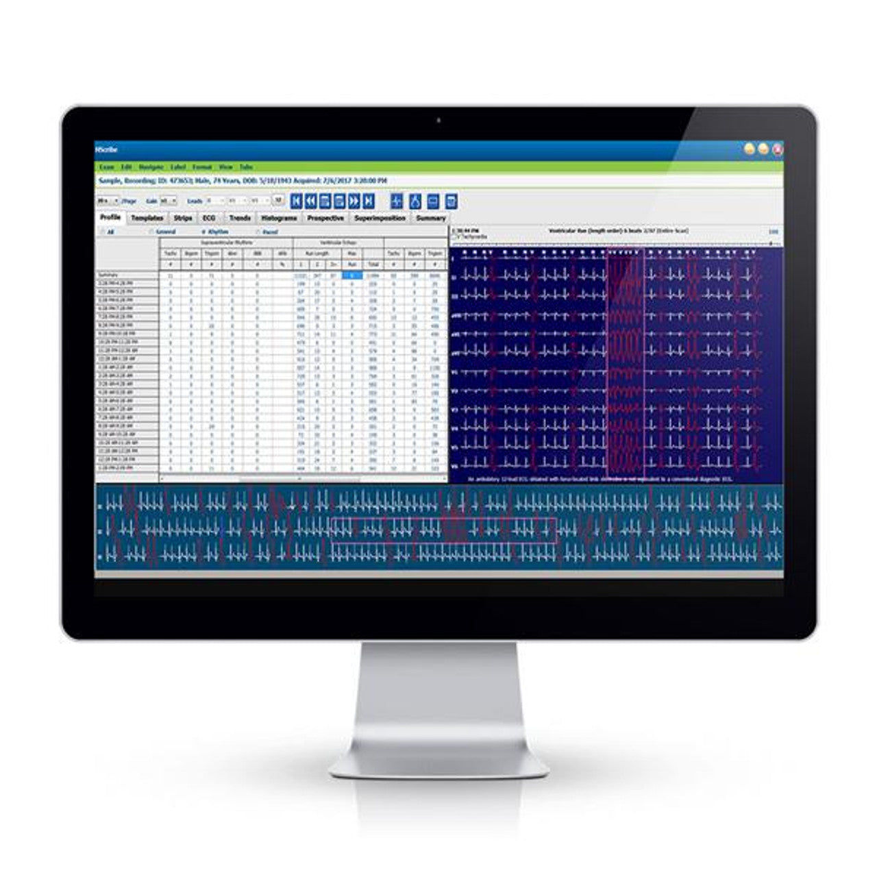 Hscribe Review Station Software Kit (US Only) (DROP SHIP ONLY)