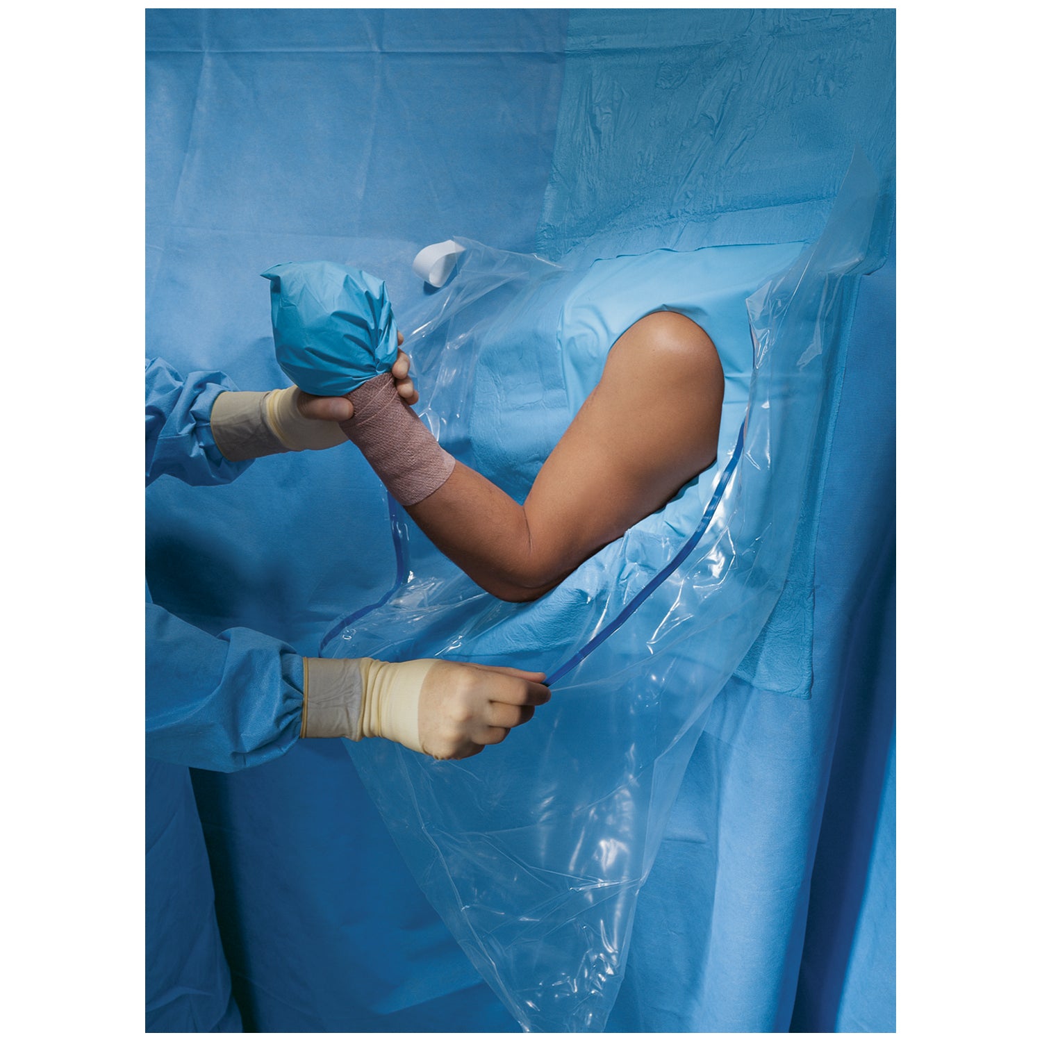 Beach Chair Shoulder Arthroscopy Drape II, Sterile, 10/cs (US Only)