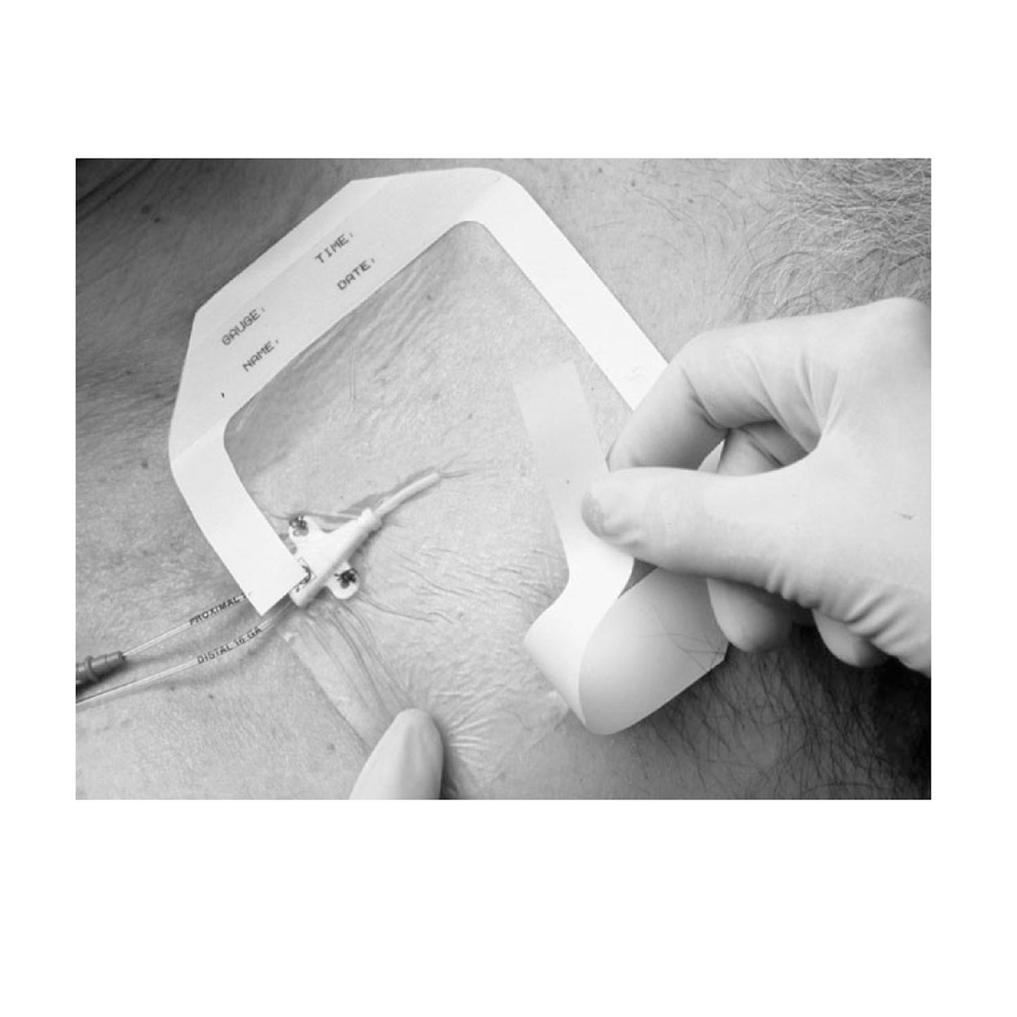 Frame Style Transparent Dressing, 4" x 4_" with Label, 50/bx, 4 bx/cs (Continental US+HI Only)