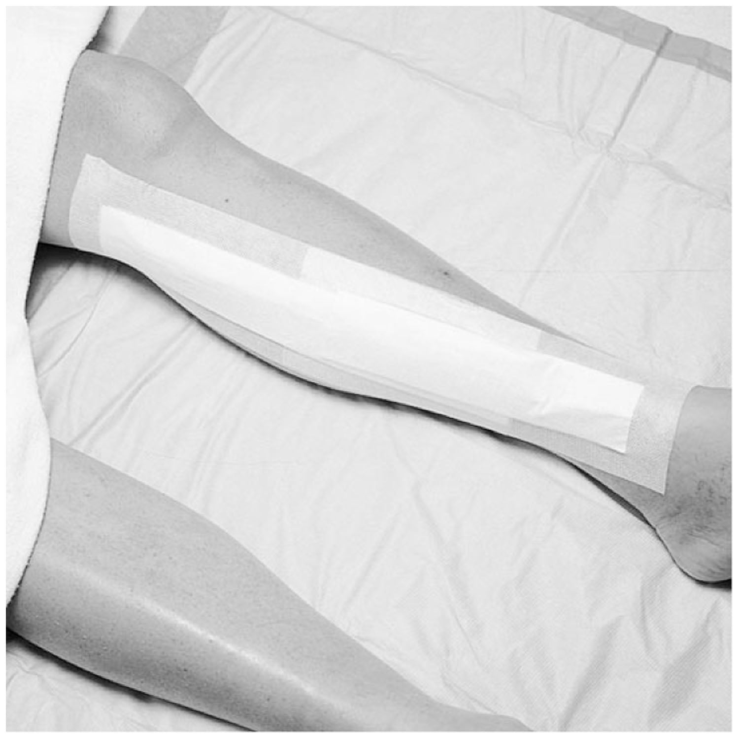 Wound Dressing, 3_" x 4", Pad Size 1_" x 2 3/8", 25/bx, 4 bx/cs (Continental US+HI Only)