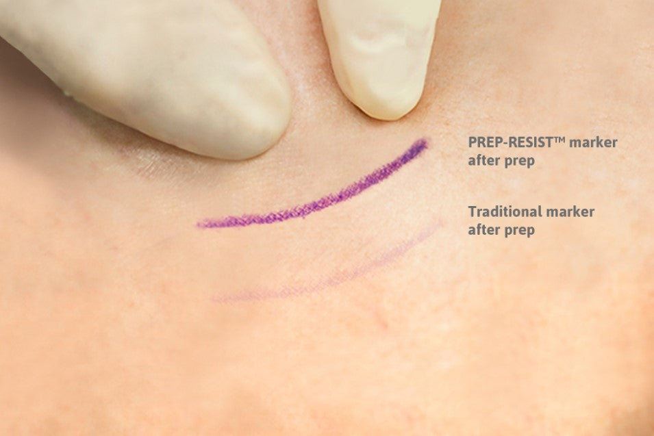 Prep-Resistant Marker, Dual Tip/ Dual Ink, Chiseled Tip, TIME OUT  Sleeve, Sterile, 25/bx, 4 bx/cs (US Only)