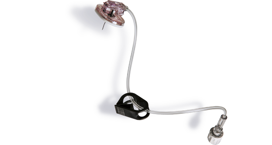 SafeStep Huber Needle Set with Y-Injection Site, 19G x 0.75", 25/pk (Continental US Only) (Drop Ship Requires Pre-Approval)