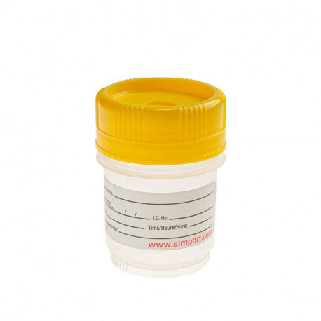 Urine Container, 60mL, Non-Sterile, 500/cs (20 cs/plt)