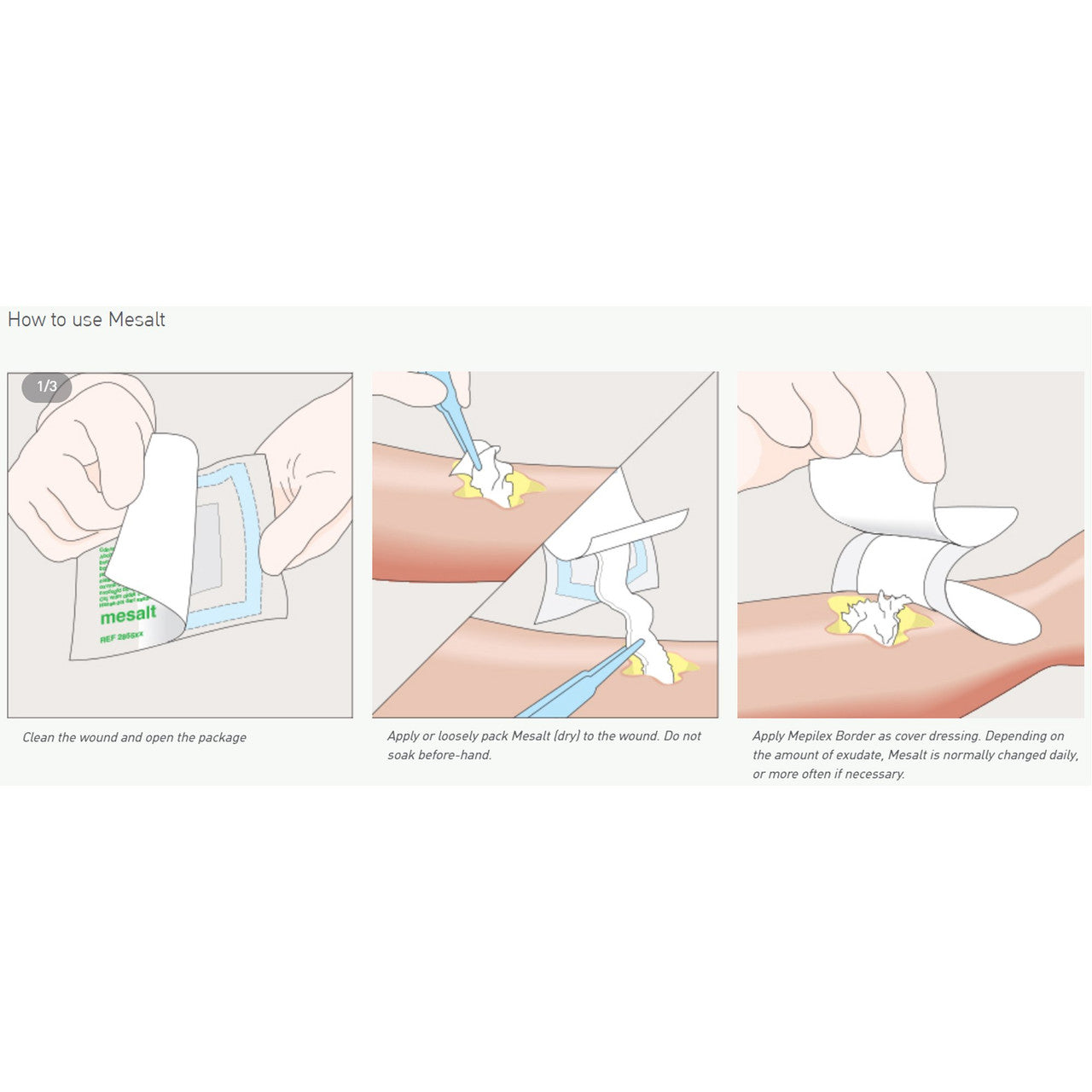 Impregnated Wound Dressing, 8" x 8", 30/bx, 6 bx/cs (US Only)