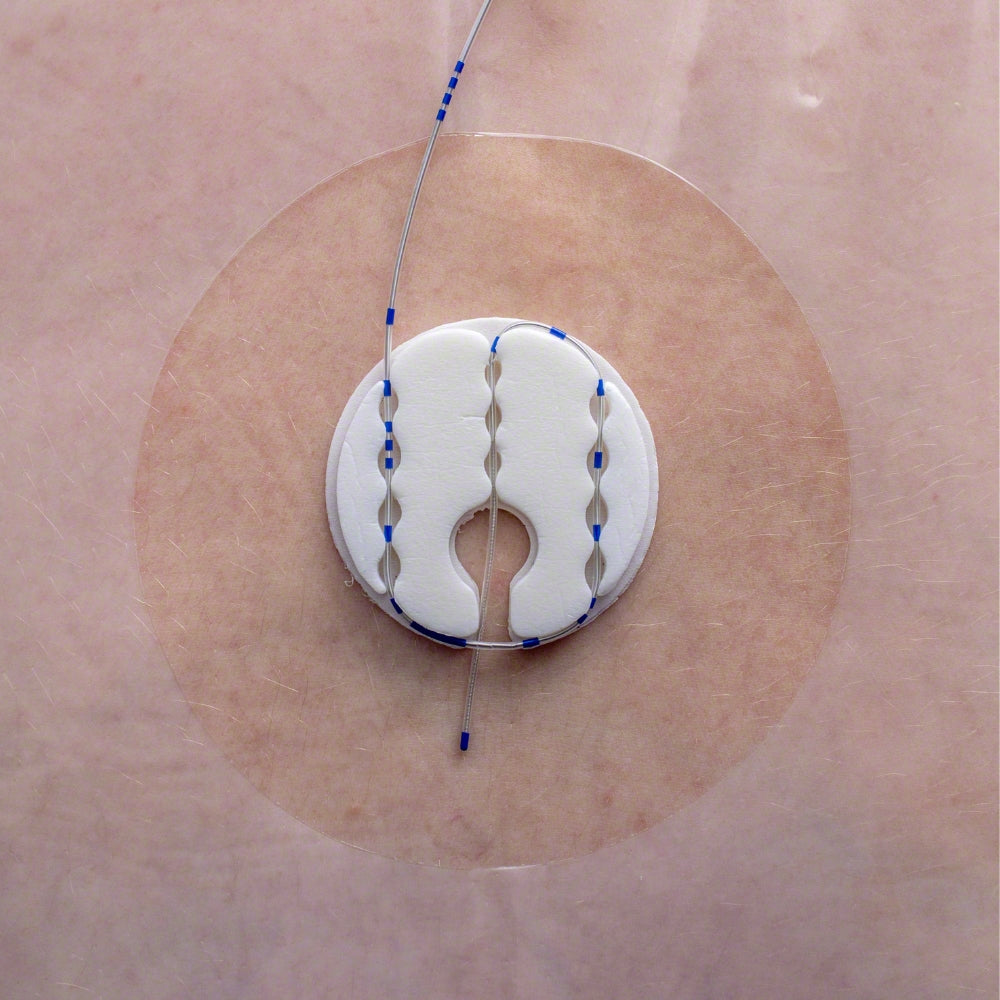 Clik-FIX Epidural PNB Catheter Device, All-in-One, 50/bx, 8 bx/cs (Rx) (Continental US+HI Only)