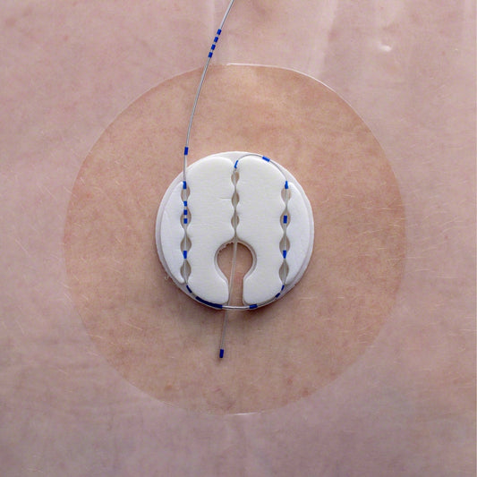 Clik-FIX Epidural PNB Catheter Device, All-in-One, 50/bx, 8 bx/cs (Rx) (Continental US+HI Only)