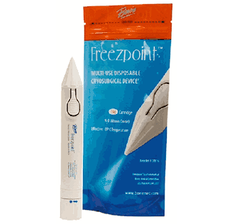 Freezpoint Cryosurgery Device