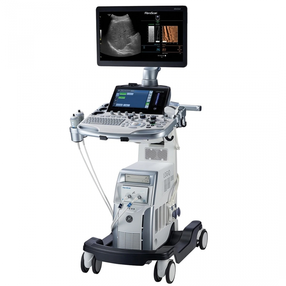 Elastography (DROP SHIP ONLY) (Continental US Only) (Not Available to Vet or Government Markets) (Pricing Listed is an Estimate and may Change without Prior Notification; Please Contact your GE Sales Rep for an Accurate Price Quote) 