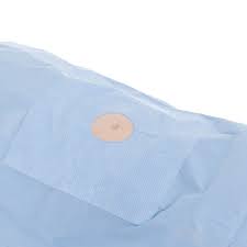 KC100 Fenestrated Drape, Minor Procedure, 76" x 124", Non-Sterile, Bulk, 60/cs (US Only)