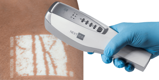 1 Year Enhanced Support Add On (Covers Vein System and Stand with Fast Replacement) (DROP SHIP ONLY)