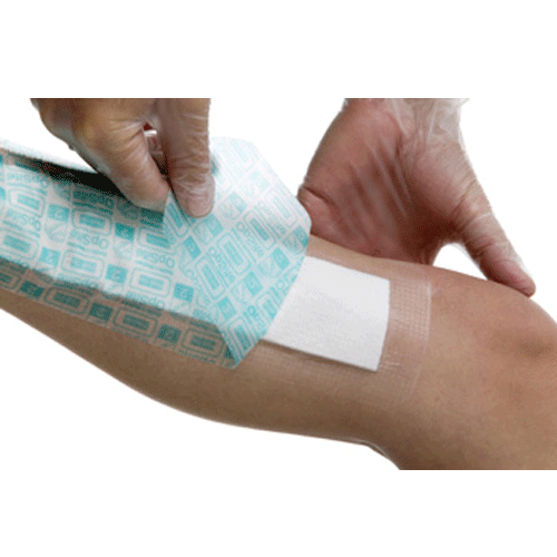 Composite Dressing, 13_" x 4", 20/bx, 8 bx/cs (US Only)