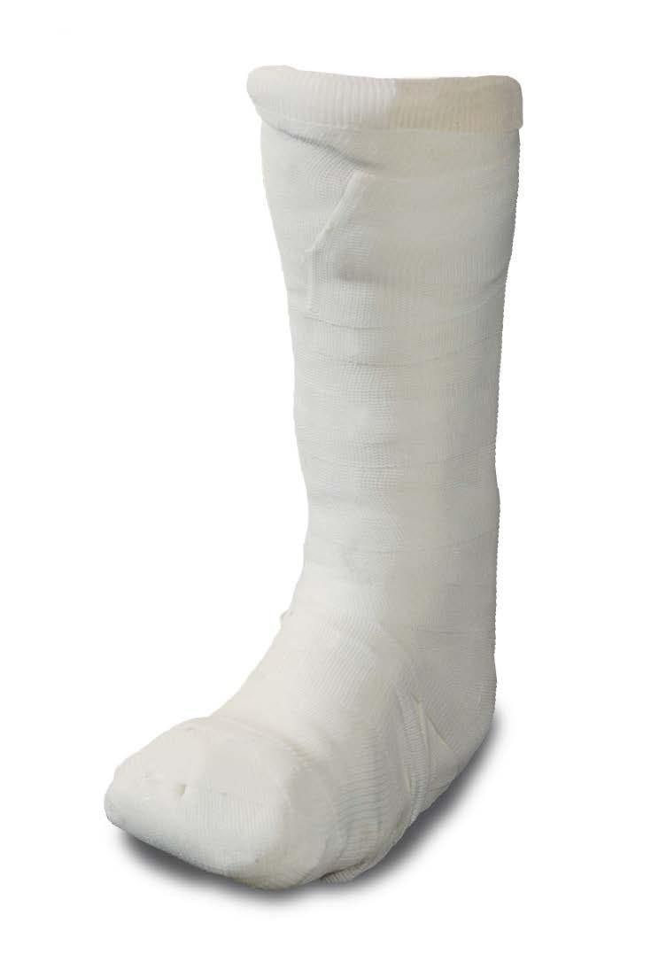 Fiberglass Cast Tape, 3" Roll, 10/cs